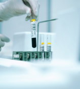 a gloved hand holding a test tube filled with liquid